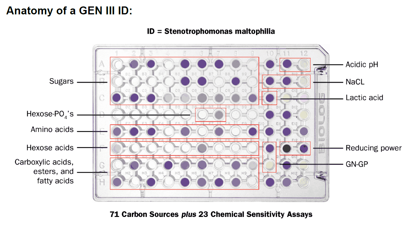 Anatomy of GEN III.PNG