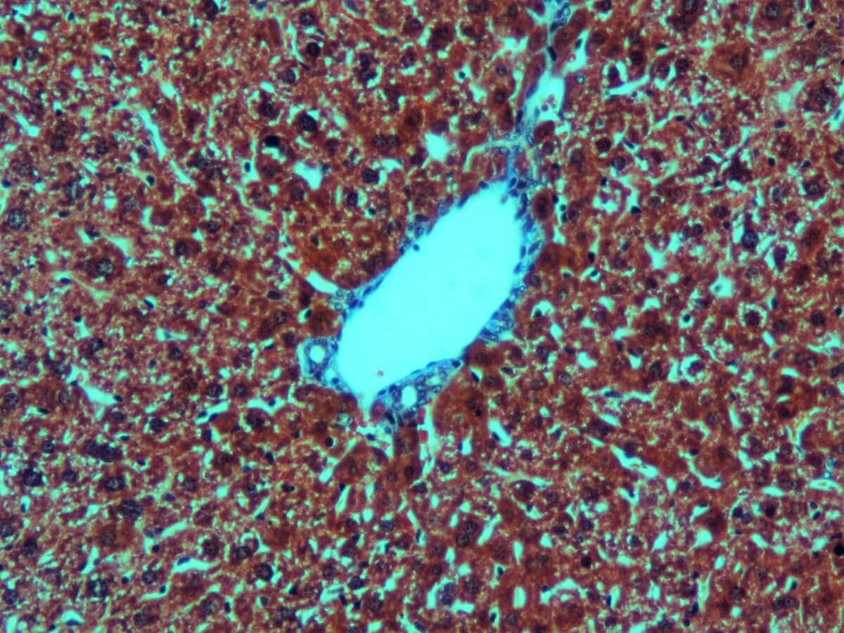 KH07007-Masson-Liver-20-x.jpg