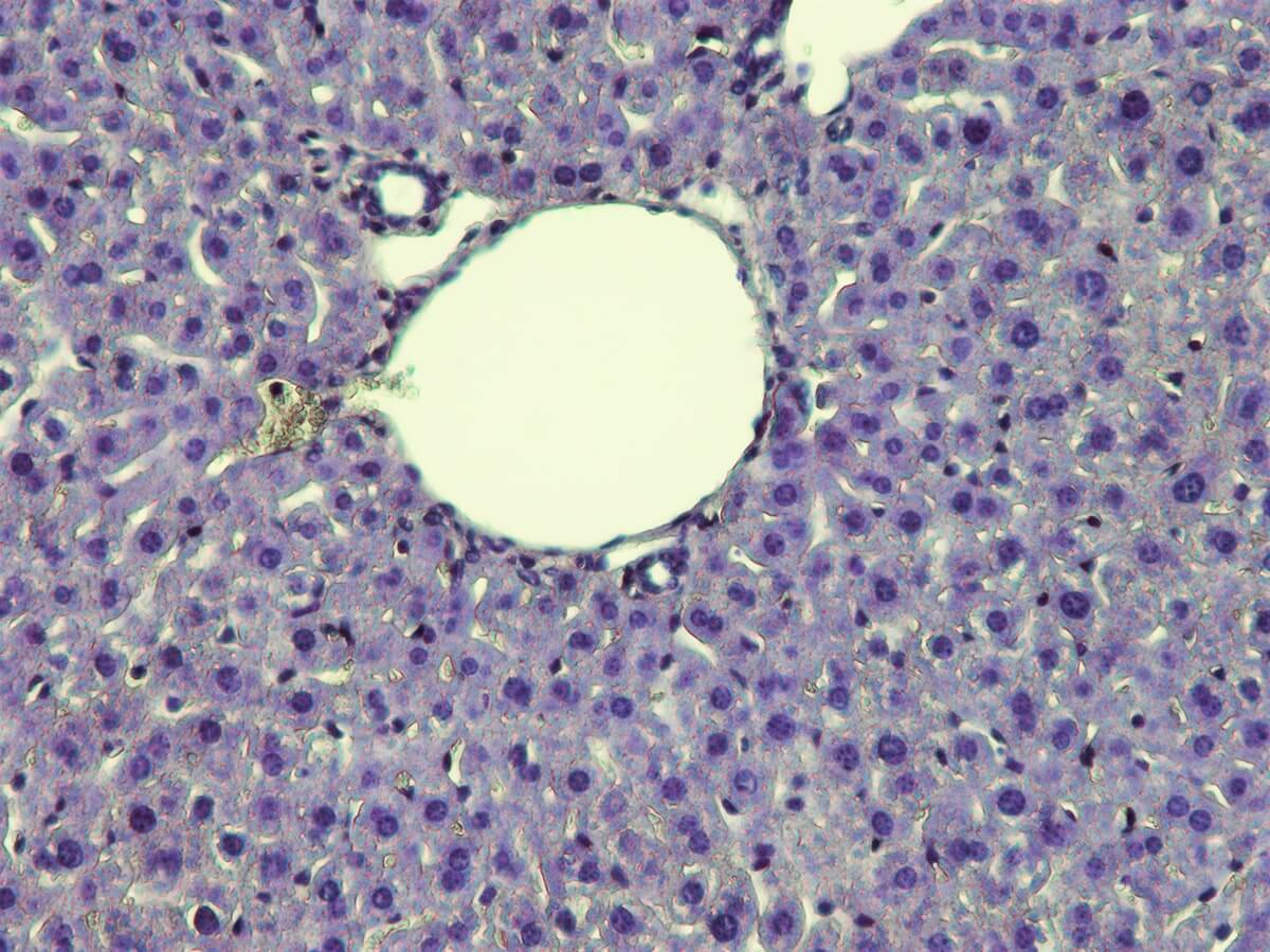 KH07004-Mayer-H-Liver-20-x.jpg