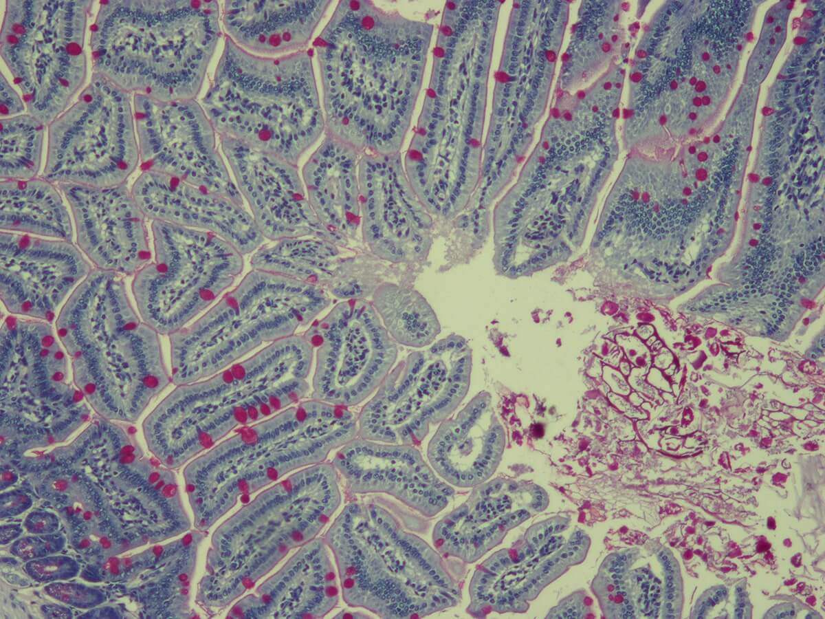 Intestino-10x-1.jpg